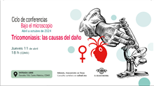 Tricomoniasis: las causas del daño